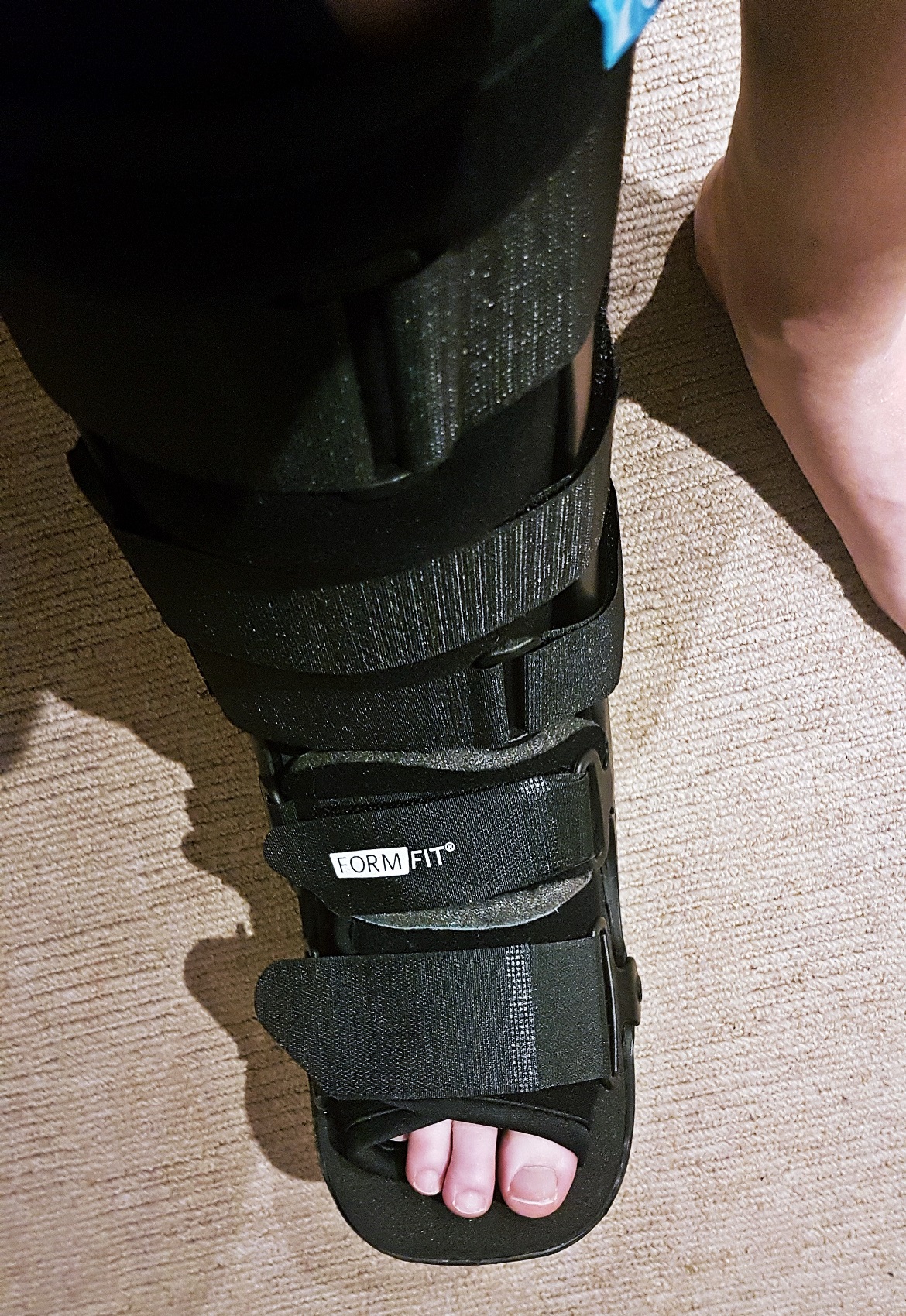 My walking boot - One Broken Foot, Two Chronic Illnesses, and the Importance of Positivity by BeckyBecky Blogs